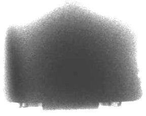 X-ray image of hall effect sensors